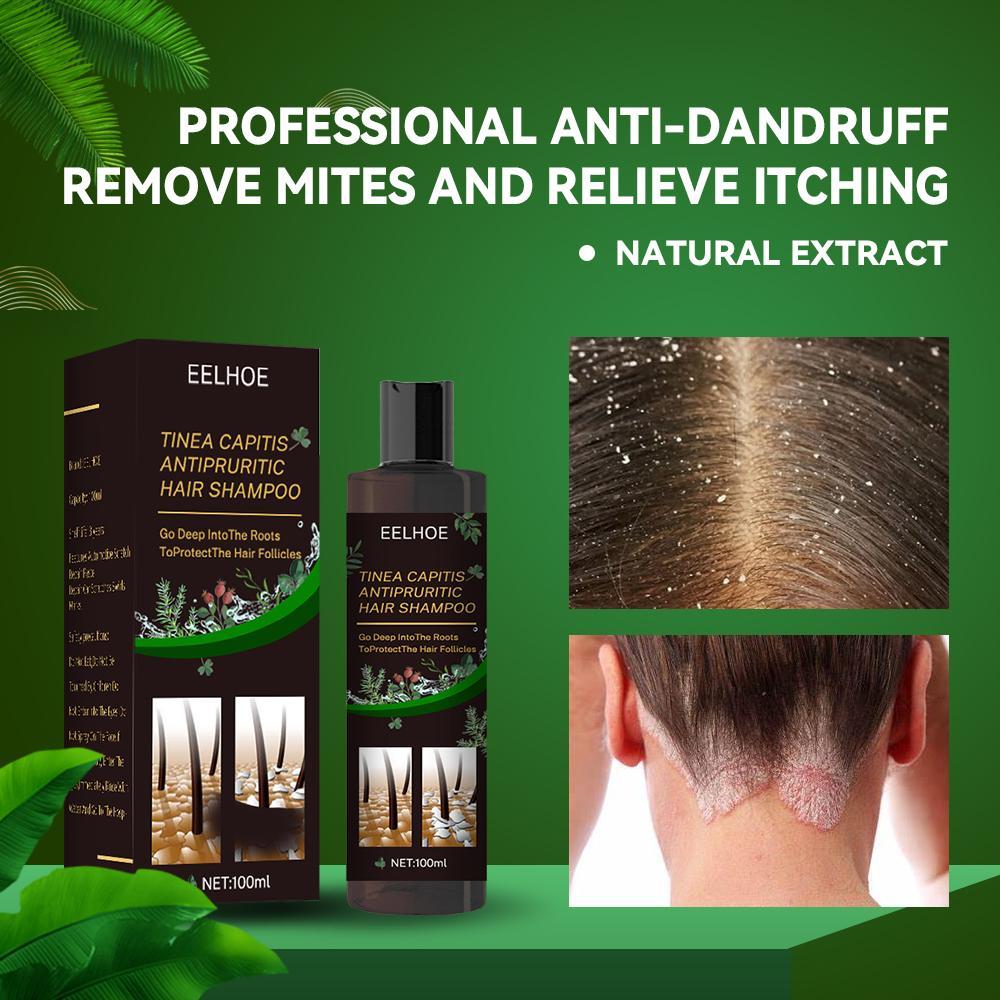 Anti-Dandruff Shampoo - Itch Relief, Hair Loss Prevention & Oil Control.