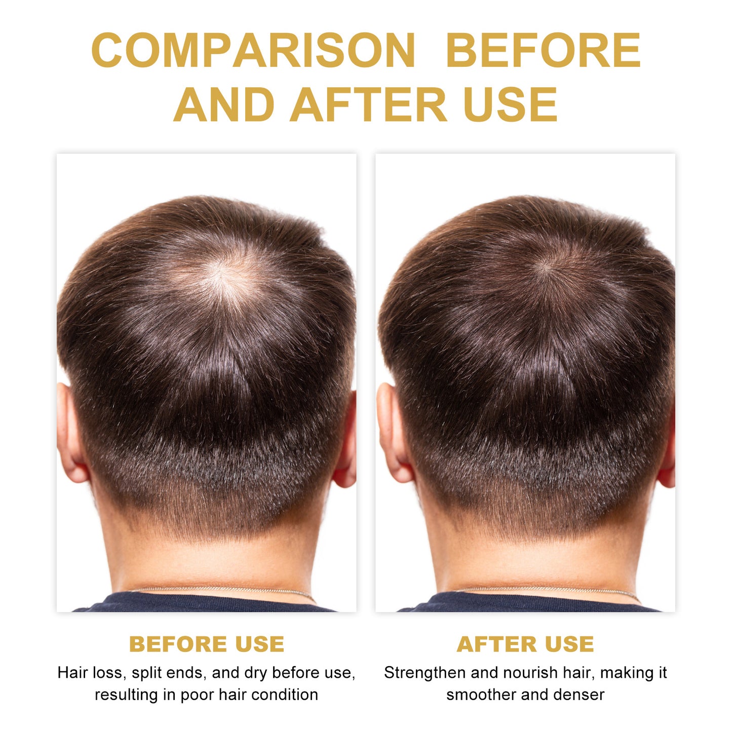 Rosemary Hair Treatment Oil - Scalp Cleansing & Repair for Dry Frizzy Hair