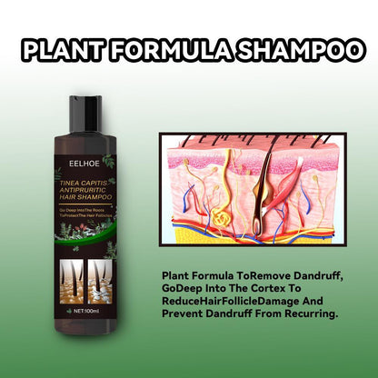 Anti-Dandruff Shampoo - Itch Relief, Hair Loss Prevention & Oil Control.