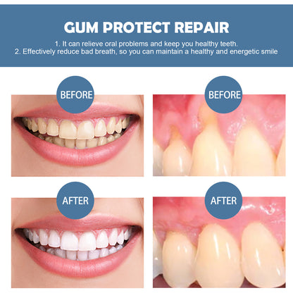 Gum Repair Toothpaste - Tooth Stain Cleaning