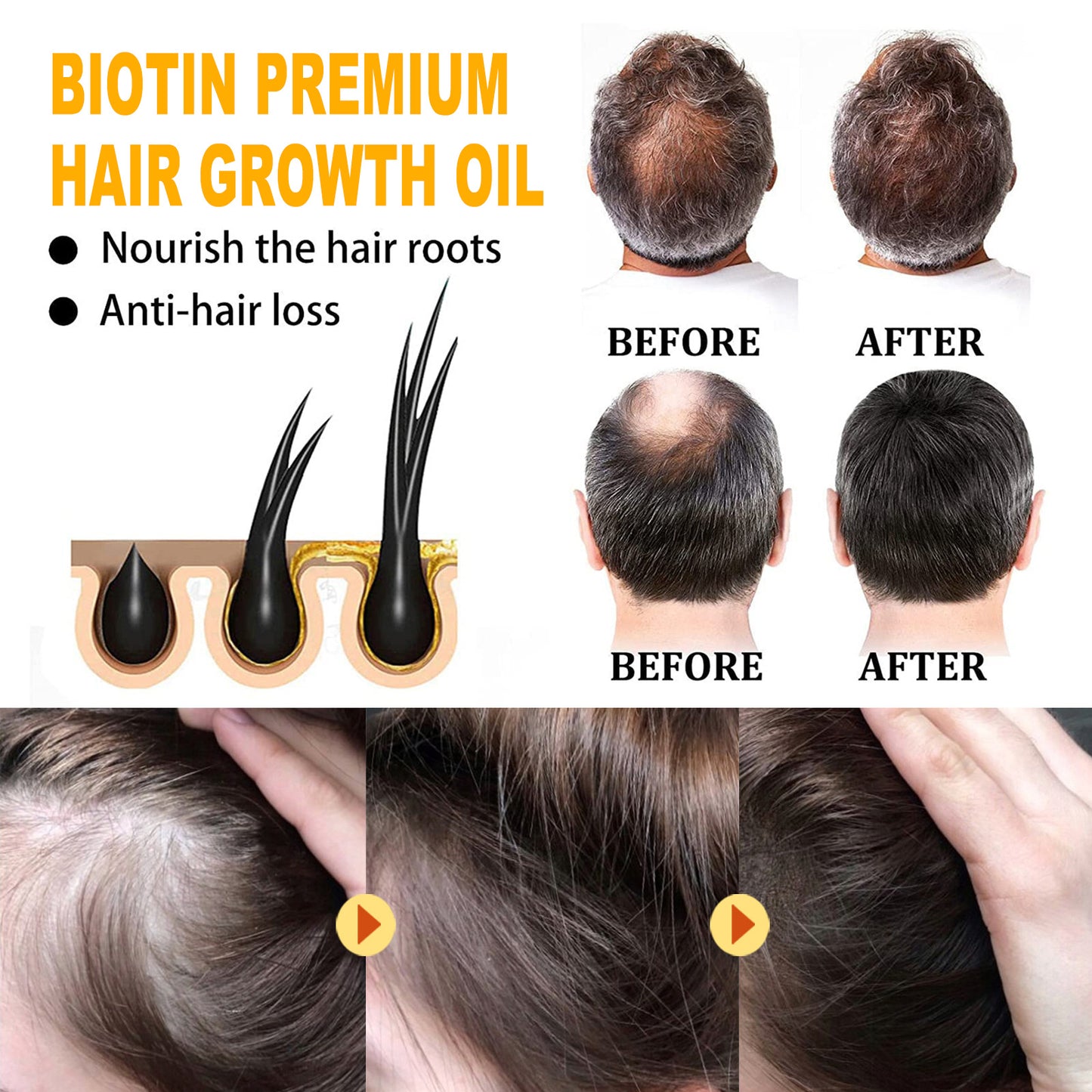 Biotin Hair Treatment Oil - Deep Moisturizing Scalp Care