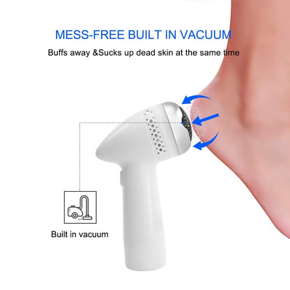 Electric Foot Grinder - Callus Remover & Dead Skin Exfoliator
