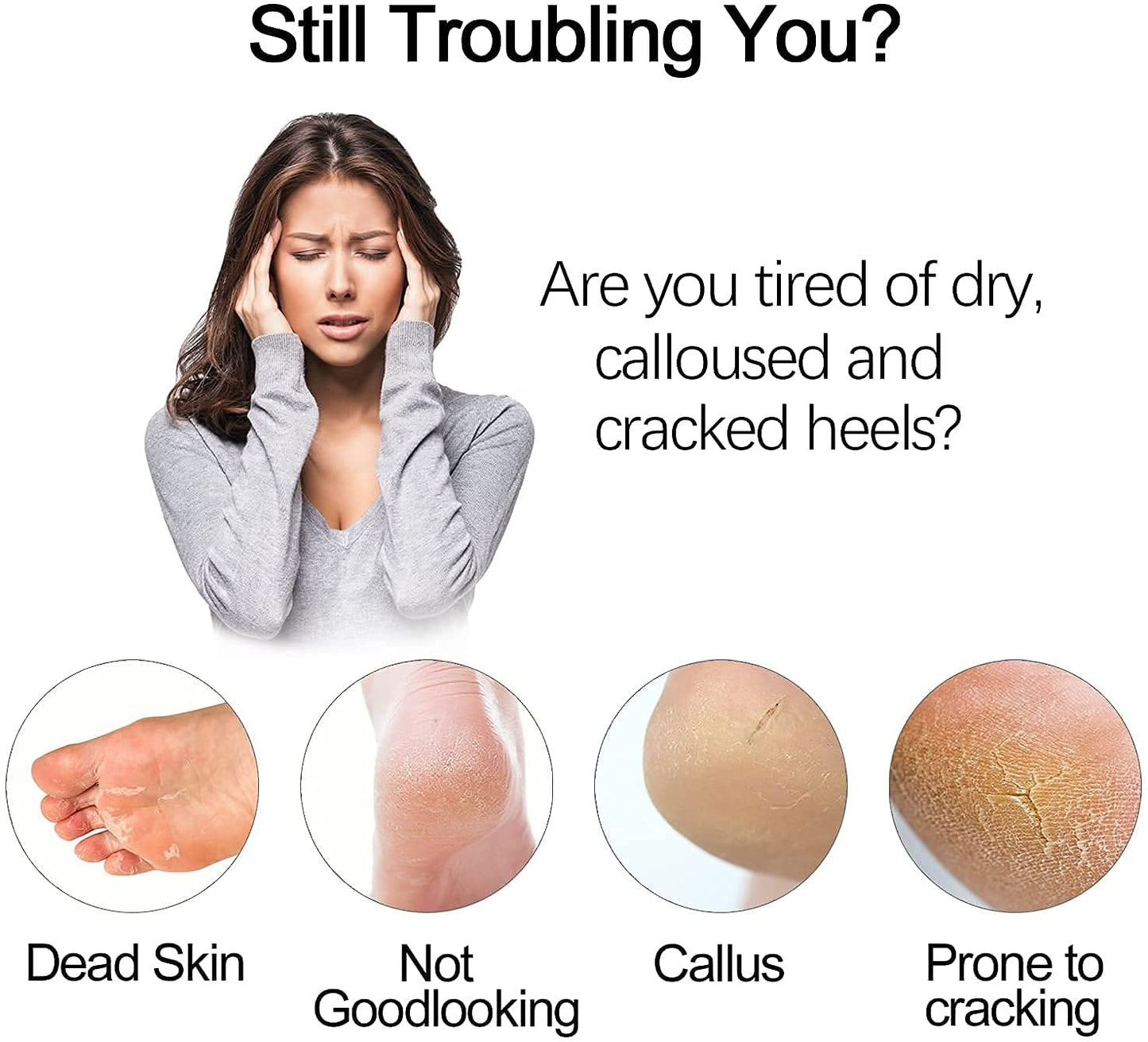 Electric Foot Grinder - Callus Remover & Dead Skin Exfoliator