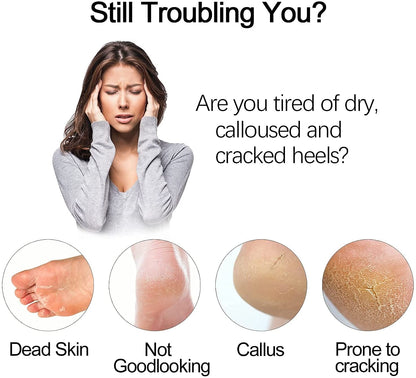 Electric Foot Grinder - Callus Remover & Dead Skin Exfoliator