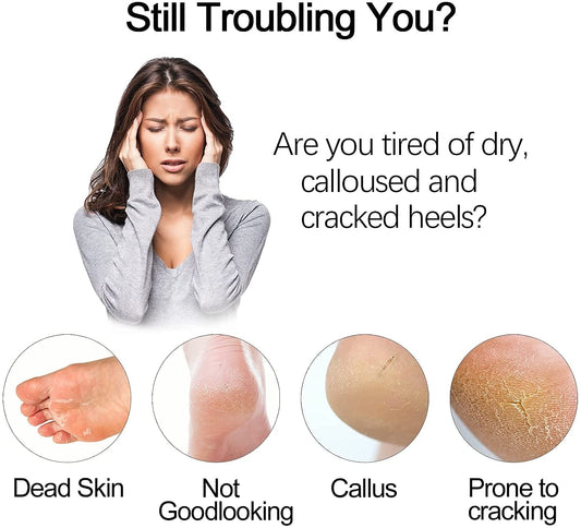 Electric Foot Grinder - Callus Remover & Dead Skin Exfoliator