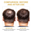 Rosemary Hair Treatment Oil