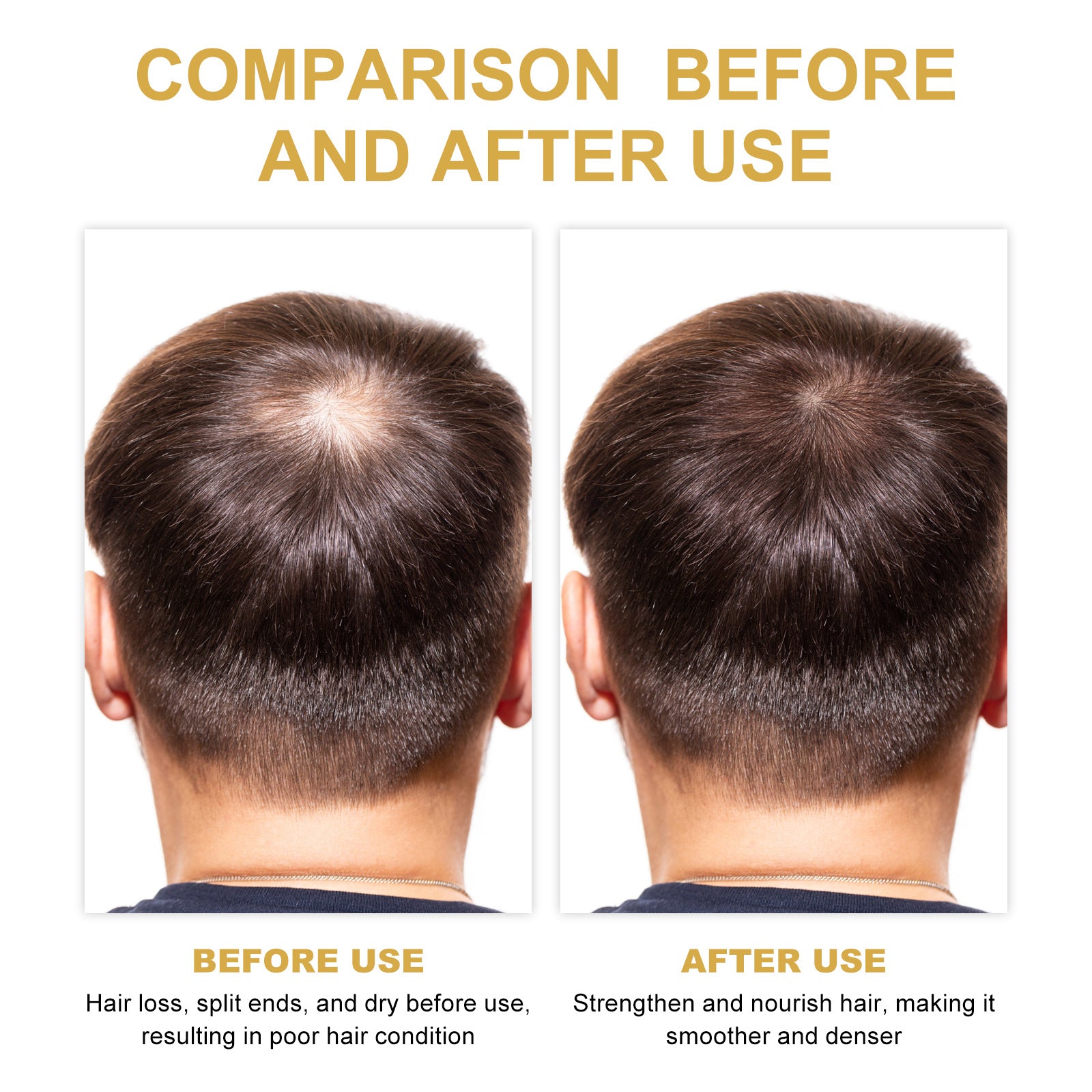 Rosemary Hair Treatment Oil